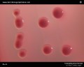 isolated lactose-positive colonies of Klebsiella on MacConkey